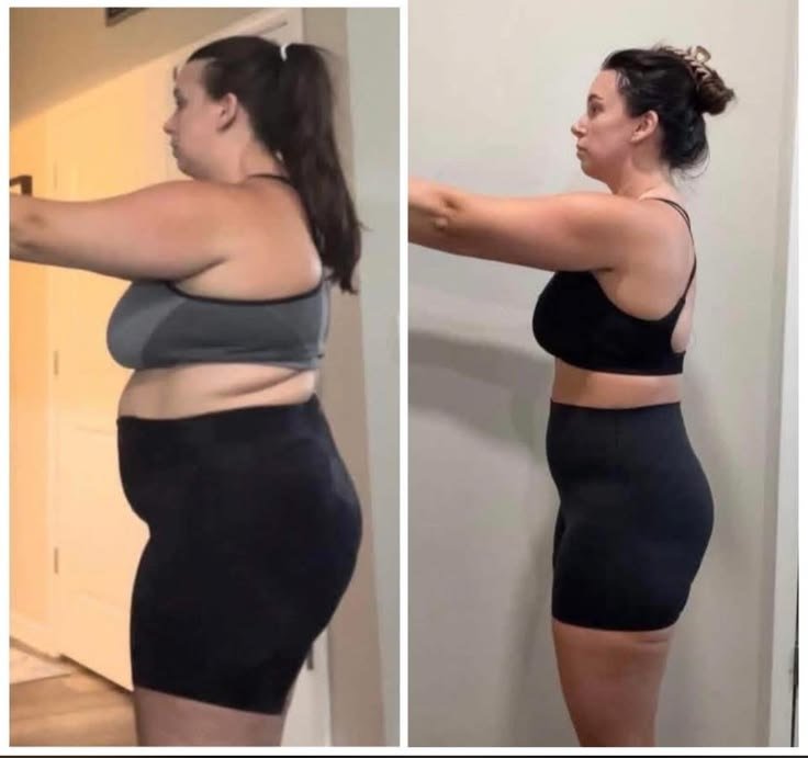 Antes y después de Milagros C.